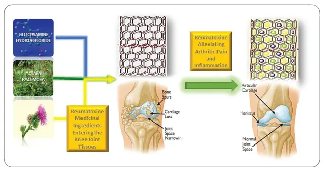 Approach To Arthritis Pain and Connective Tissue Repair
