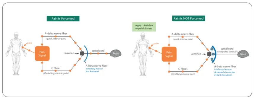 Approach To Arthritis Pain and Connective Tissue Repair